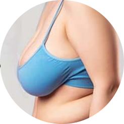Saggy Breast